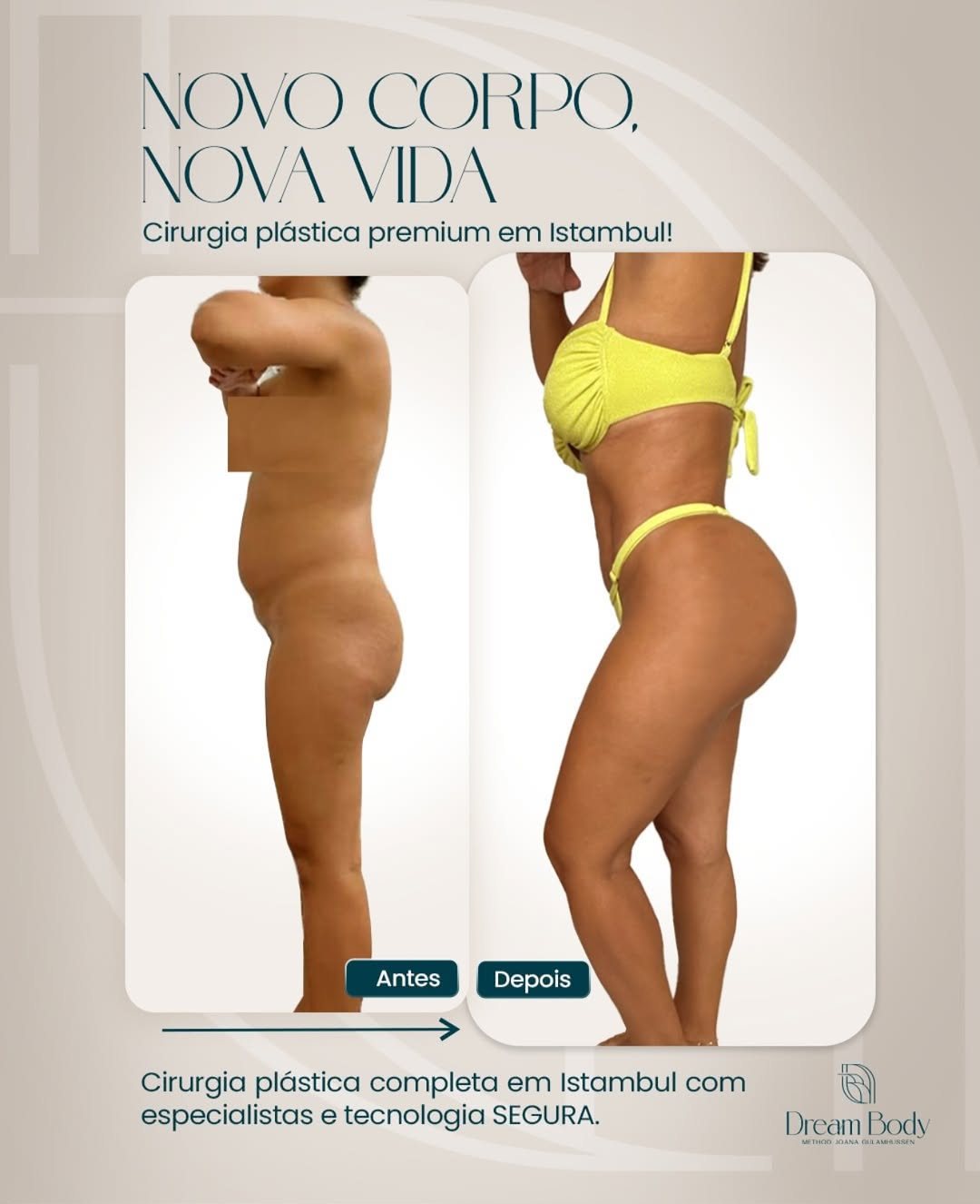 Novo corpo, nova vida — Dream Body Clinic